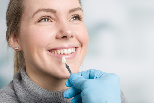 most-asked-questions-about-veneers-in-2023